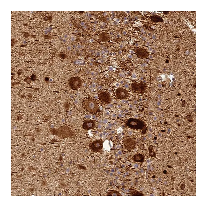 Atlas Antibodies Anti-BCDIN3D Antibody