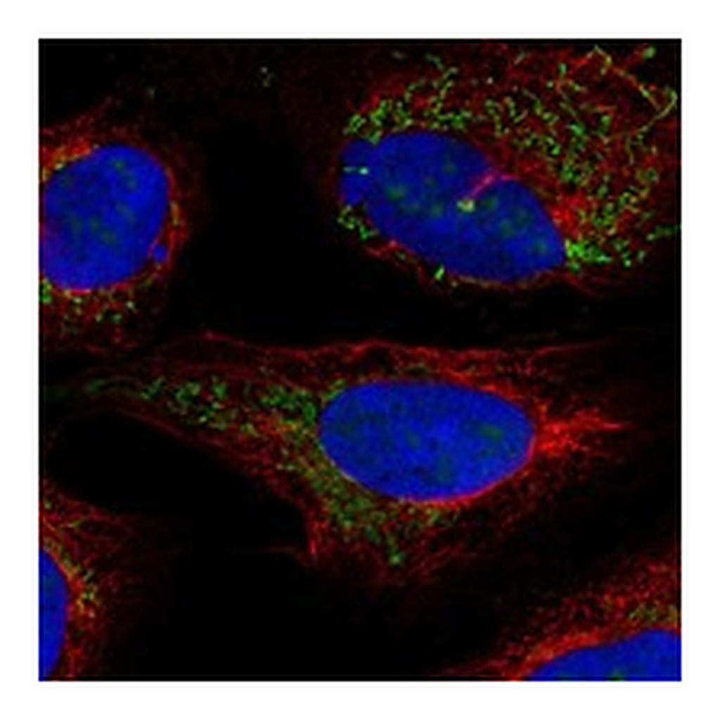 Atlas Antibodies Anti-BCKDHB Antibody