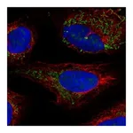 Atlas Antibodies Anti-BCKDHB Antibody