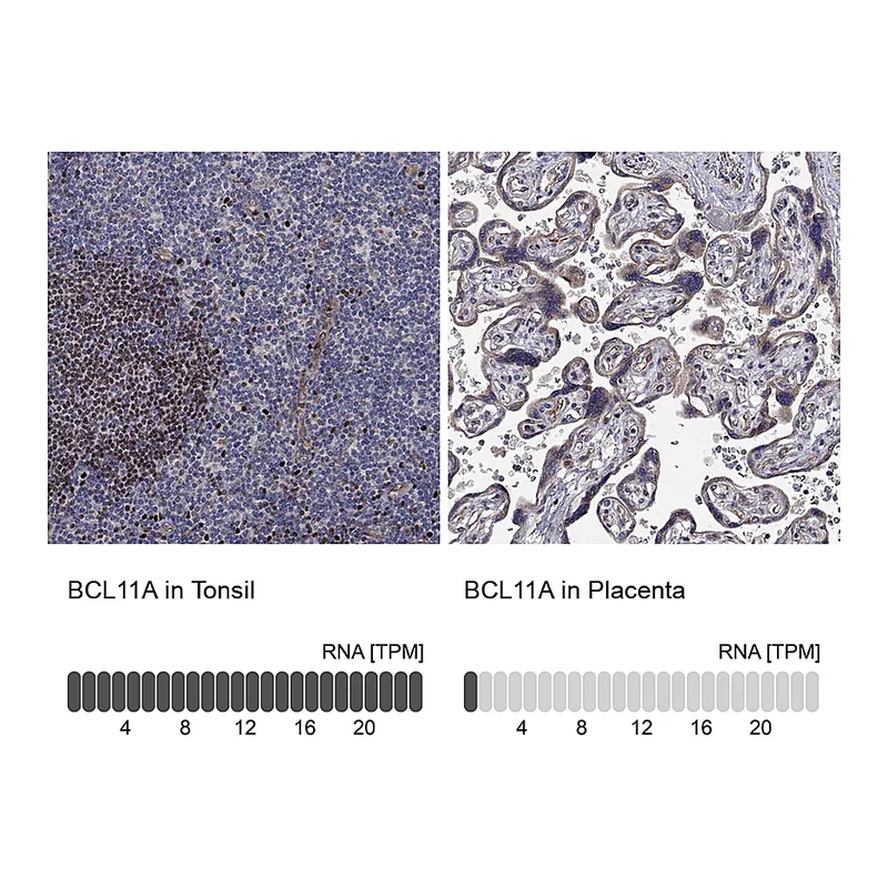 Atlas Antibodies Anti-BCL11A Antibody