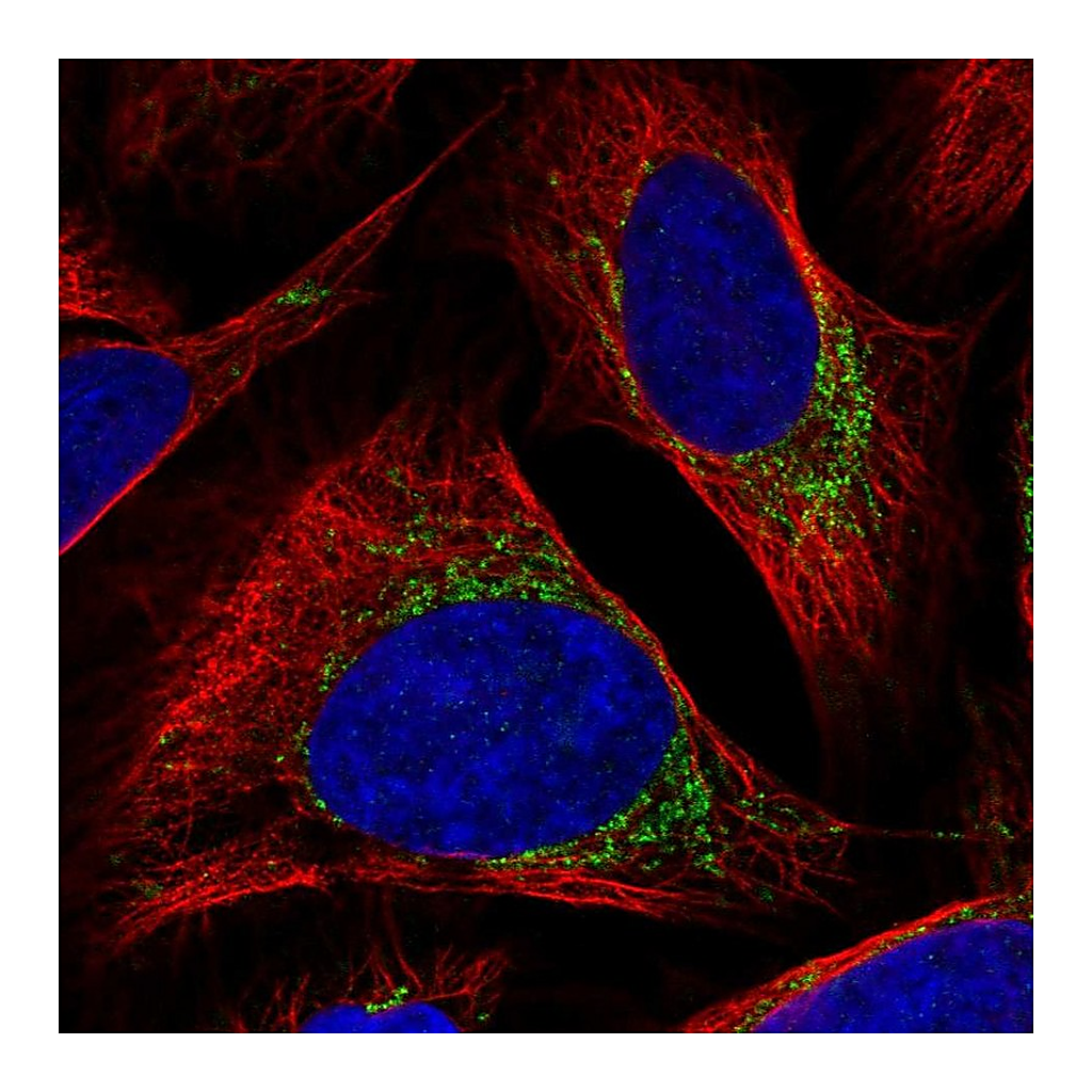 Atlas Antibodies Anti-BCKDK Antibody