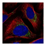 Atlas Antibodies Anti-BCKDK Antibody