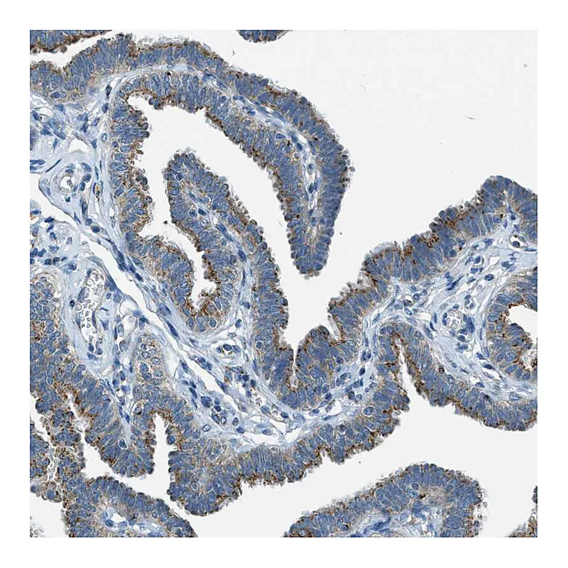 Atlas Antibodies Anti-BCKDK Antibody