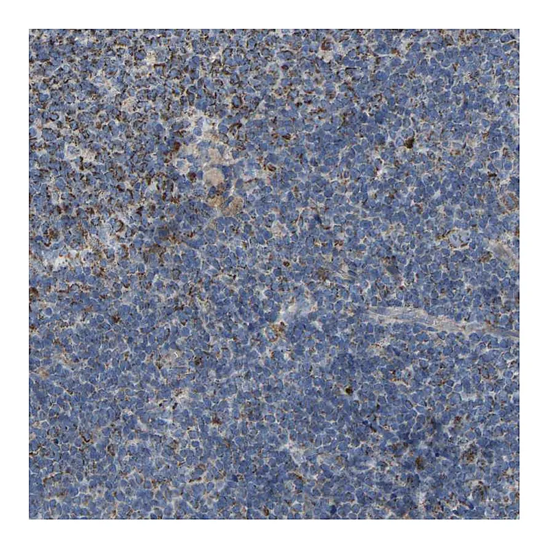 Atlas Antibodies Anti-BCL10 Antibody