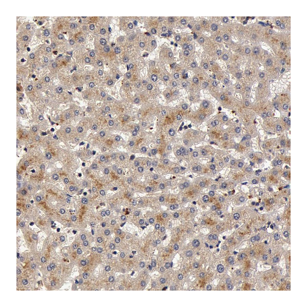 Atlas Antibodies Anti-BCHE Antibody