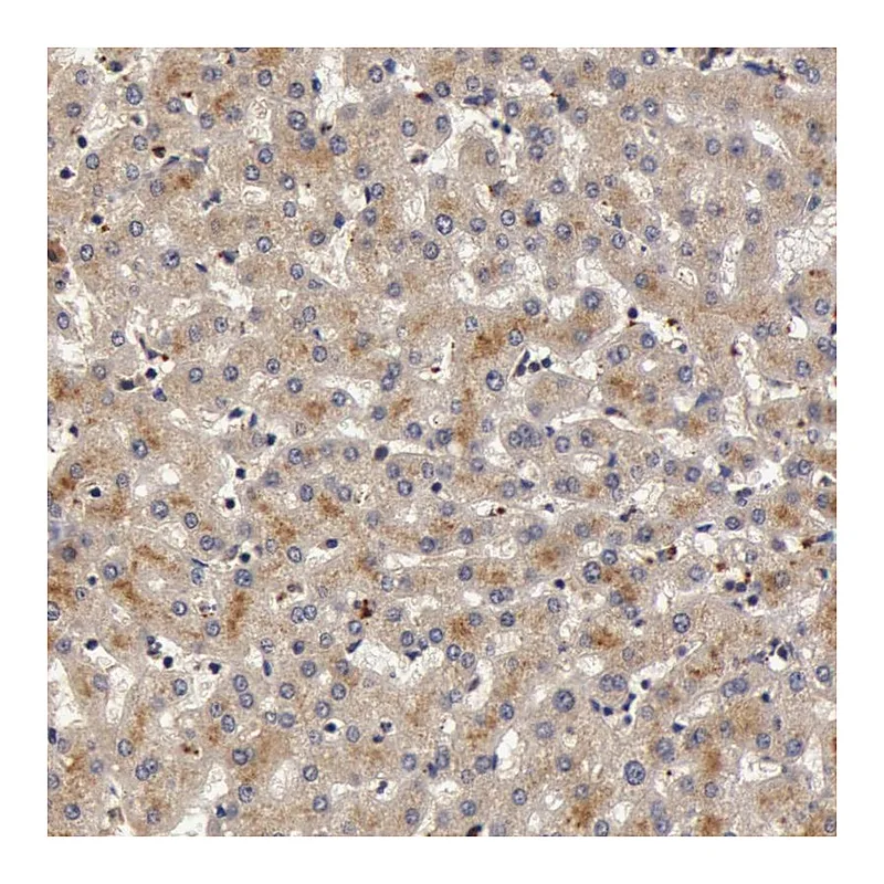 Atlas Antibodies Anti-BCHE Antibody