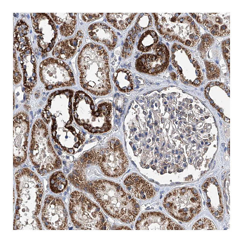Atlas Antibodies Anti-BCKDHB Antibody