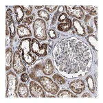 Atlas Antibodies Anti-BCKDHB Antibody