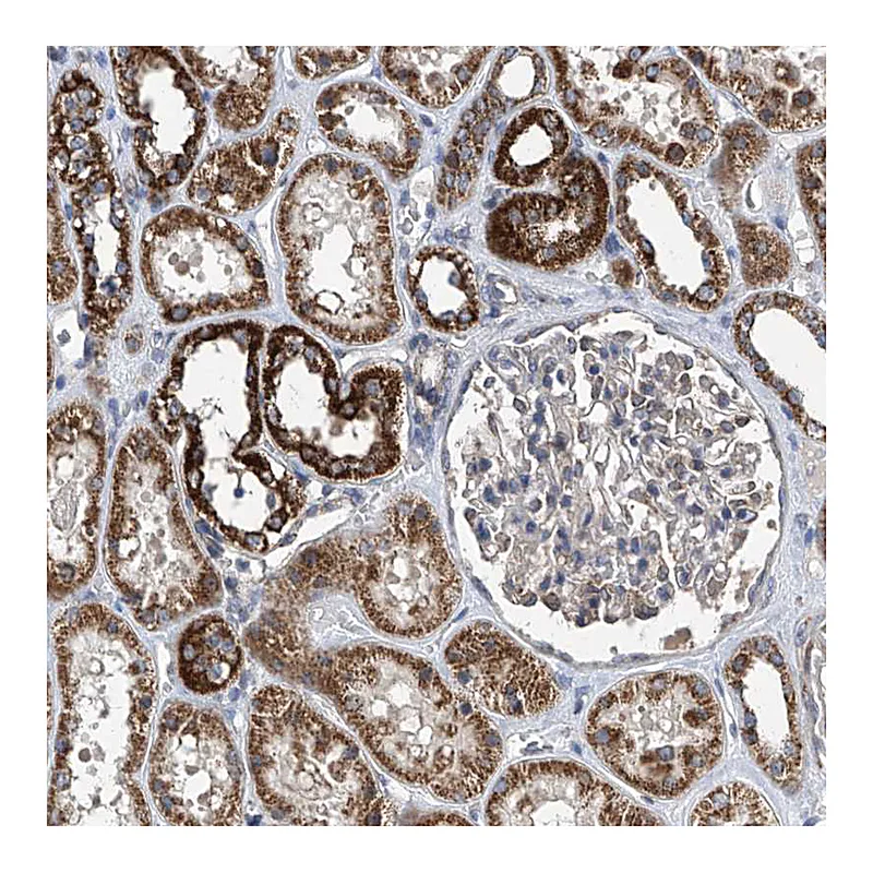 Atlas Antibodies Anti-BCKDHB Antibody