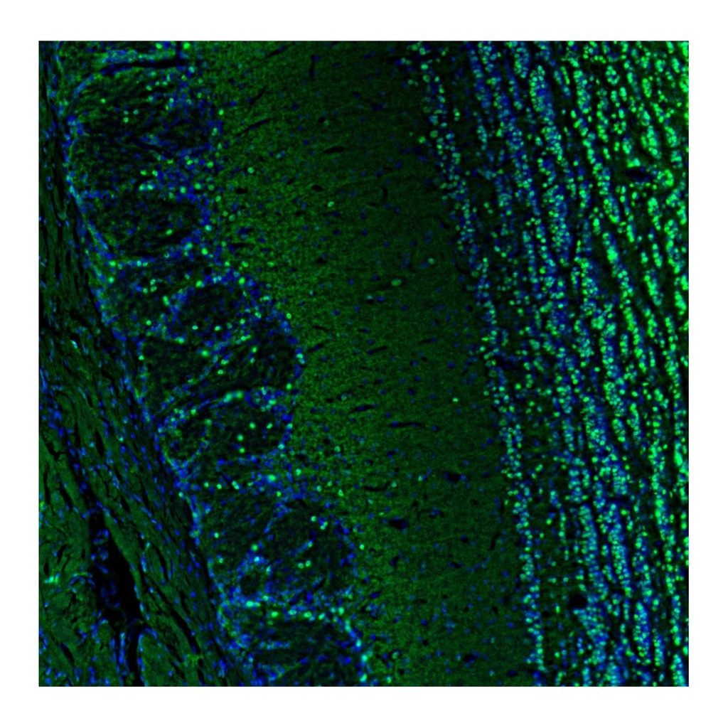 Atlas Antibodies Anti-BCL11B Antibody