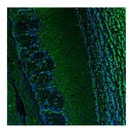 Atlas Antibodies Anti-BCL11B Antibody