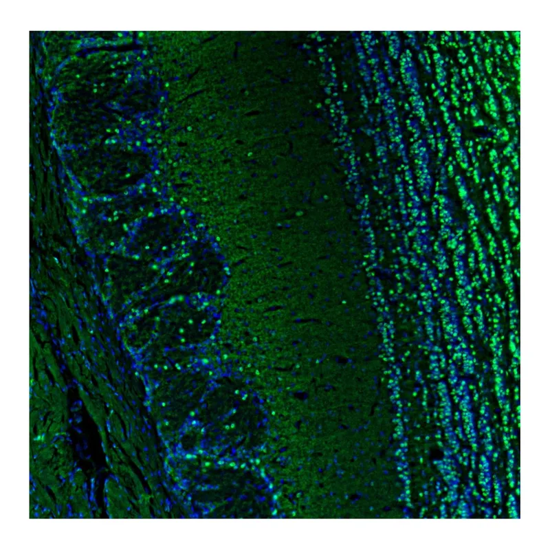 Atlas Antibodies Anti-BCL11B Antibody