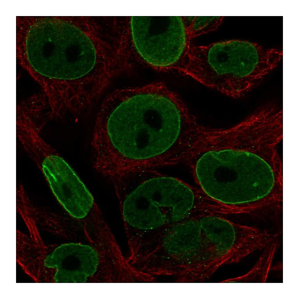 Atlas Antibodies Anti-BCL2 Antibody