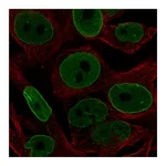 Atlas Antibodies Anti-BCL2 Antibody
