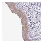 Atlas Antibodies Anti-BCL2L1 Antibody