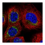 Atlas Antibodies Anti-BCL2L13 Antibody
