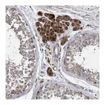 Atlas Antibodies Anti-BCL2L12 Antibody