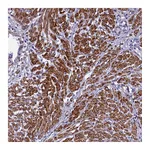 Atlas Antibodies Anti-BCL2L13 Antibody
