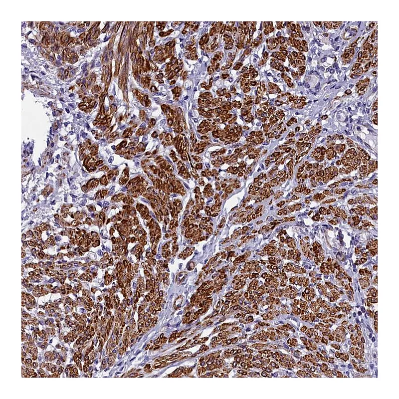 Atlas Antibodies Anti-BCL2L13 Antibody