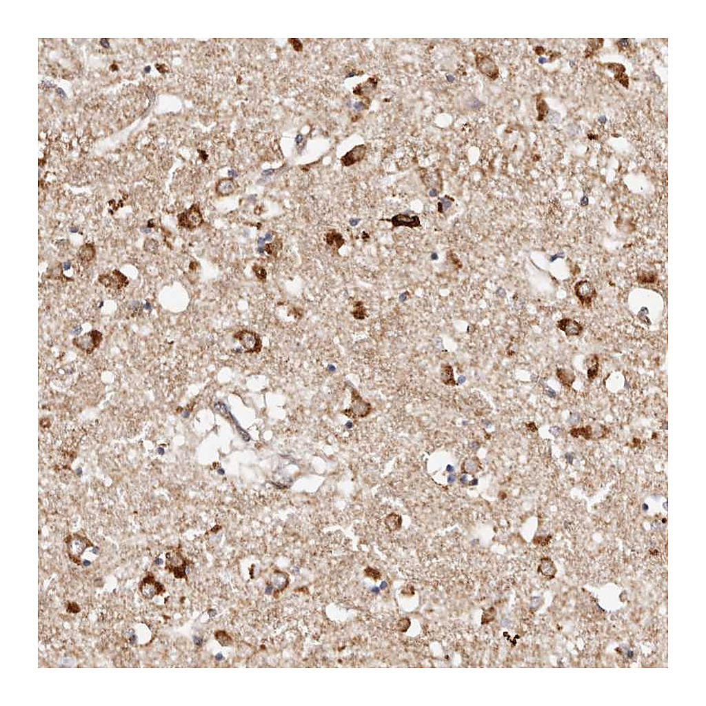 Atlas Antibodies Anti-BCL2L15 Antibody