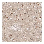 Atlas Antibodies Anti-BCL2L15 Antibody
