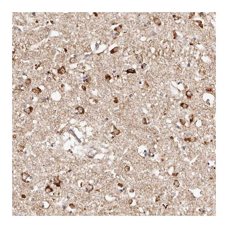 Atlas Antibodies Anti-BCL2L15 Antibody