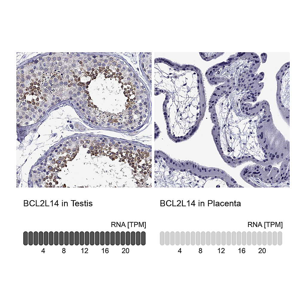 Atlas Antibodies Anti-BCL2L14 Antibody