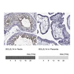 Atlas Antibodies Anti-BCL2L14 Antibody