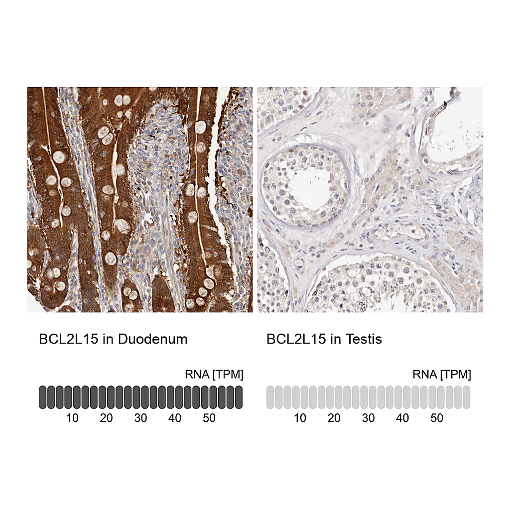 Atlas Antibodies Anti-BCL2L15 Antibody