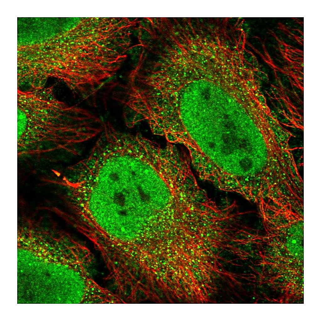 Atlas Antibodies Anti-BCL3 Antibody