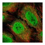 Atlas Antibodies Anti-BCL3 Antibody