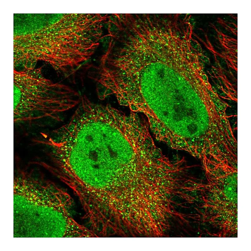 Atlas Antibodies Anti-BCL3 Antibody