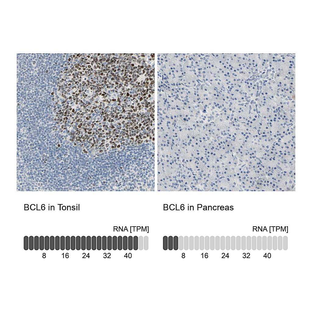 Atlas Antibodies Anti-BCL6 Antibody