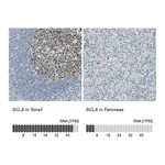 Atlas Antibodies Anti-BCL6 Antibody