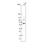 Atlas Antibodies Anti-BCL6 Antibody