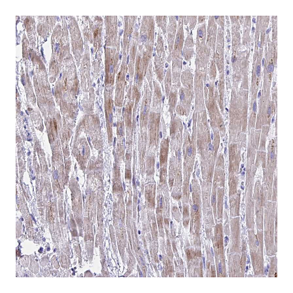 Atlas Antibodies Anti-BCL6B Antibody