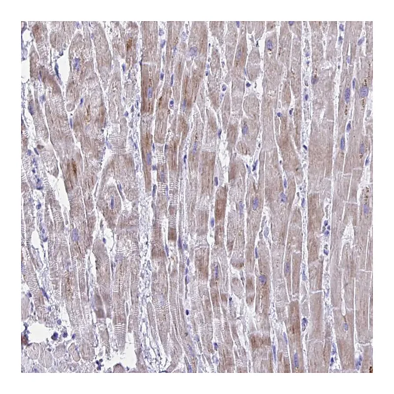 Atlas Antibodies Anti-BCL6B Antibody