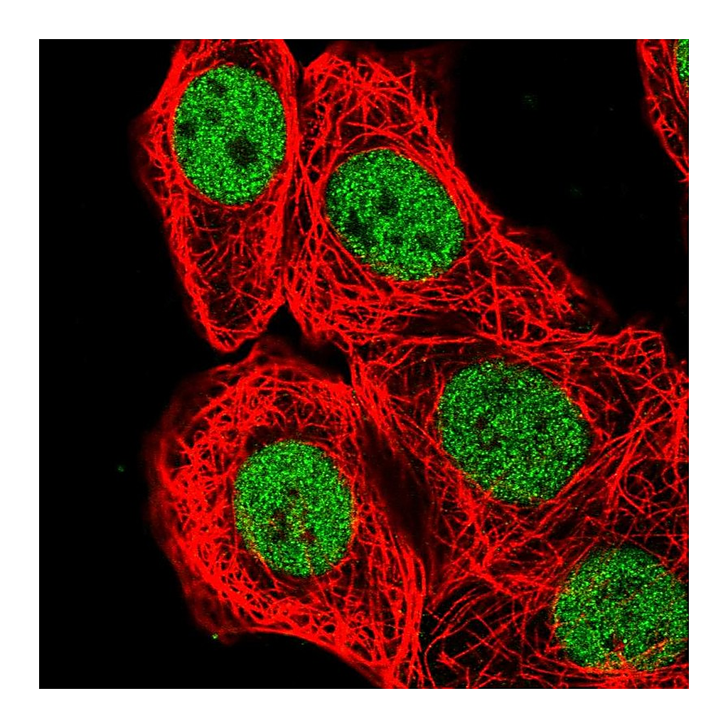 Atlas Antibodies Anti-BCL7B Antibody