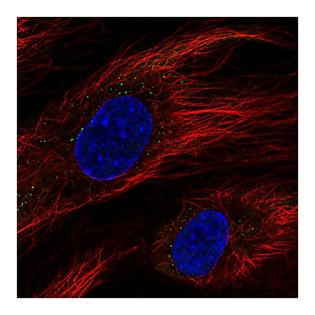 Atlas Antibodies Anti-BCL6B Antibody