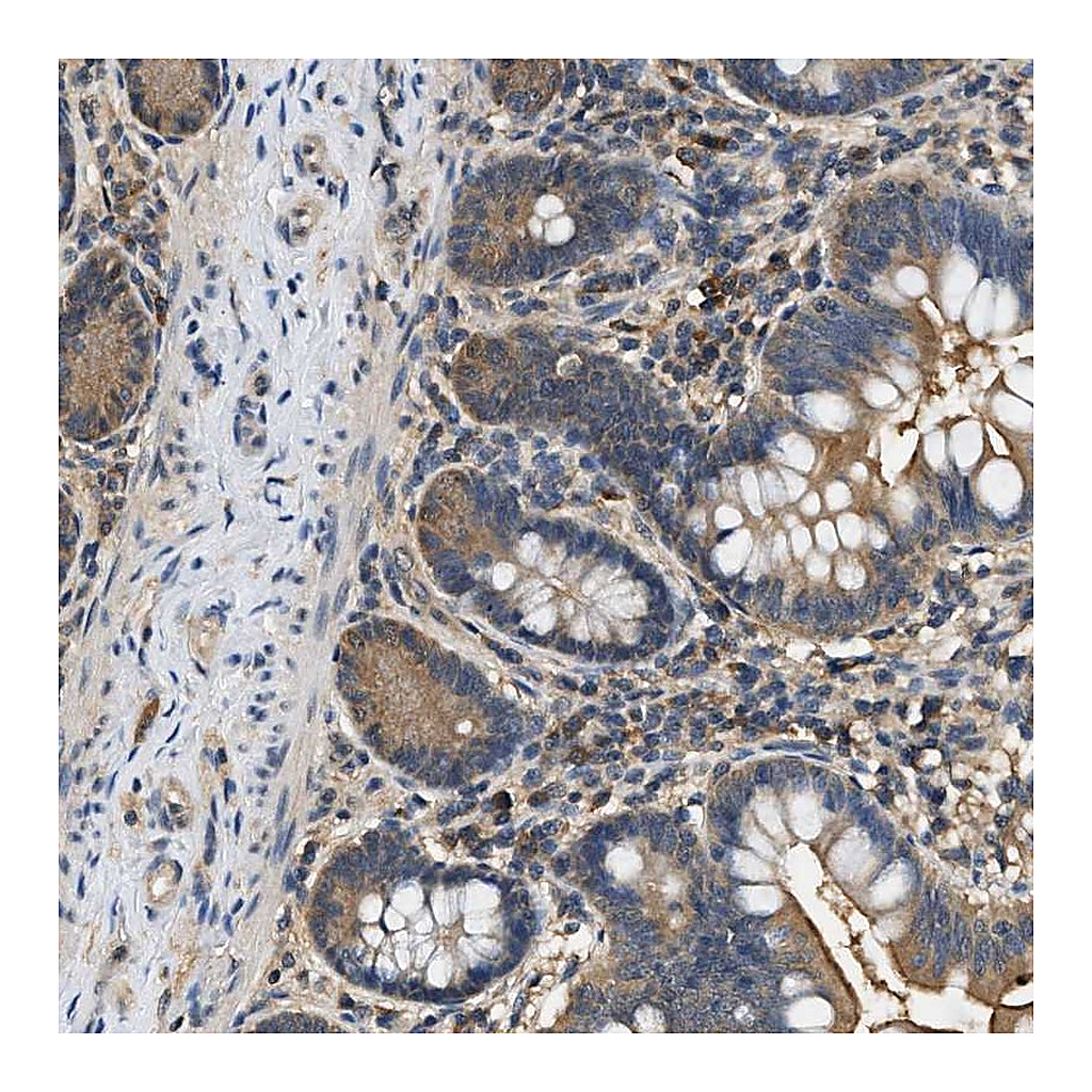 Atlas Antibodies Anti-BCL7C Antibody