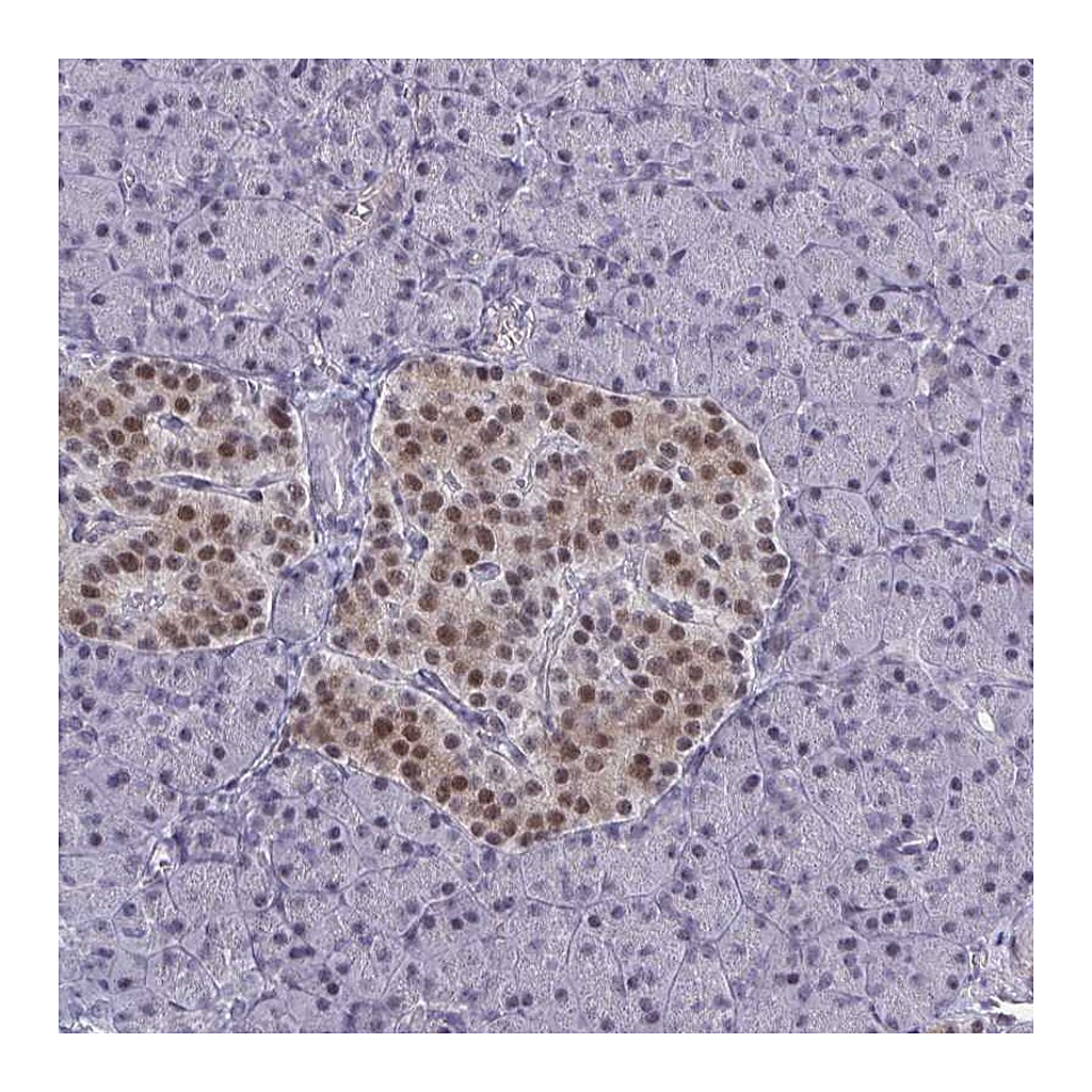 Atlas Antibodies Anti-BCL7B Antibody