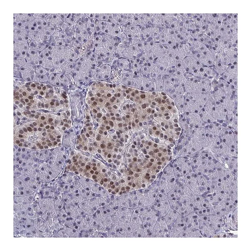 Atlas Antibodies Anti-BCL7B Antibody