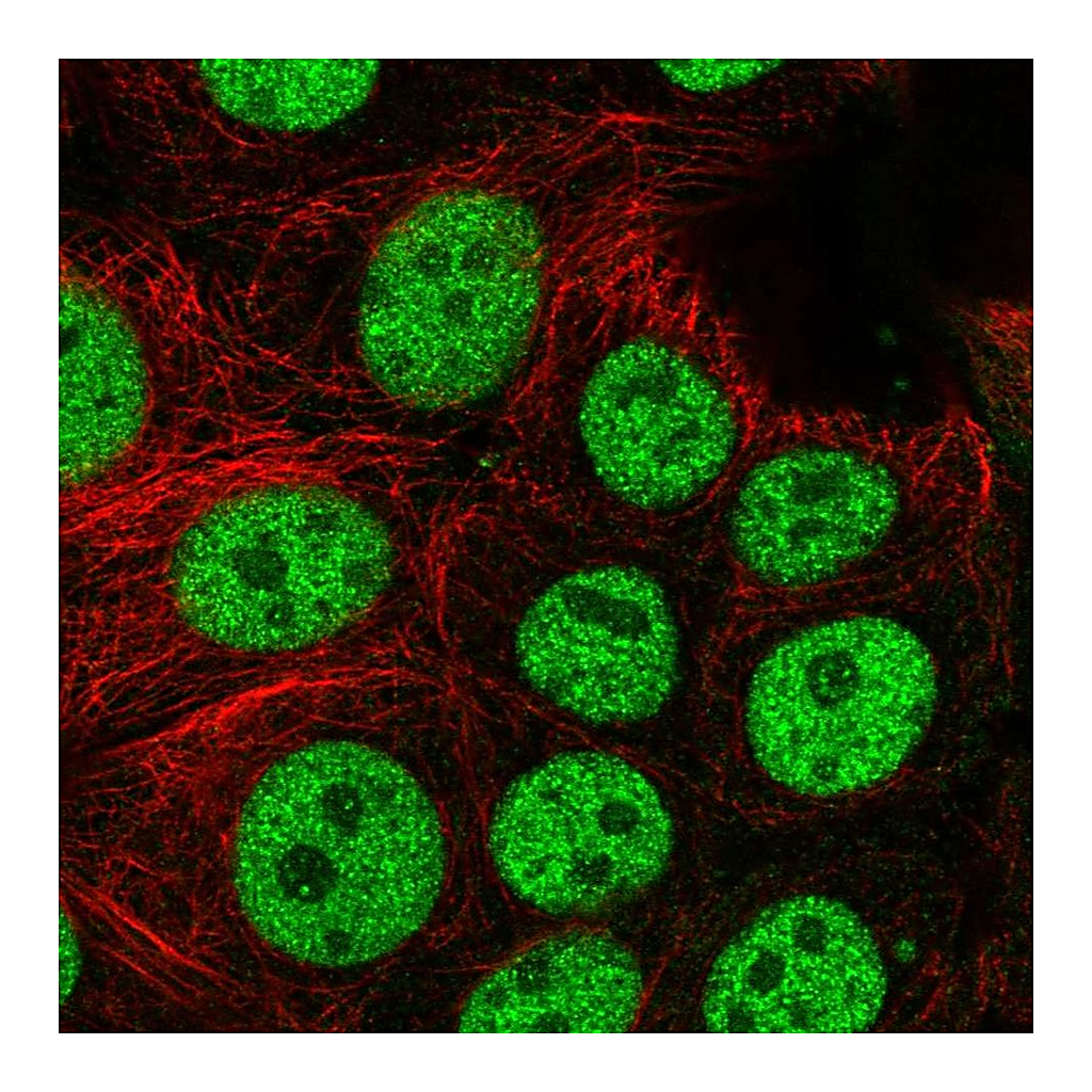 Atlas Antibodies Anti-BCL7C Antibody