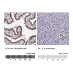 Atlas Antibodies Anti-BCL9 Antibody