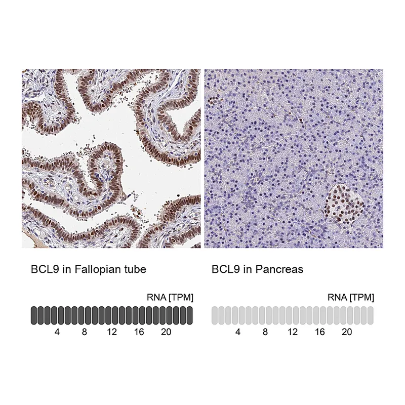 Atlas Antibodies Anti-BCL9 Antibody