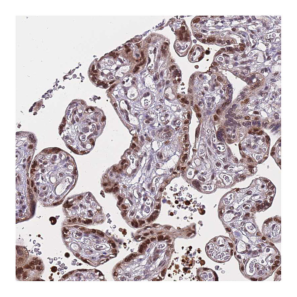 Atlas Antibodies Anti-BCL9L Antibody