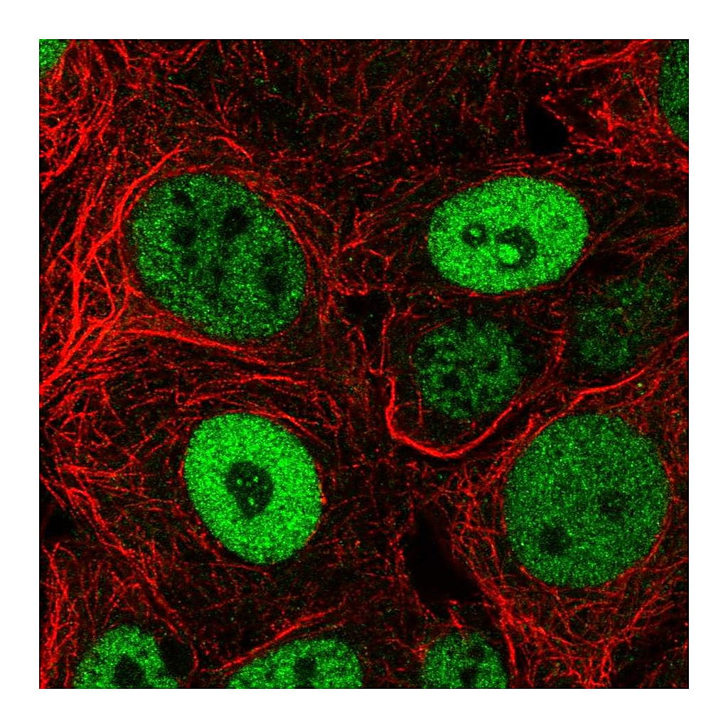Atlas Antibodies Anti-BCL9L Antibody