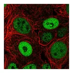 Atlas Antibodies Anti-BCL9L Antibody