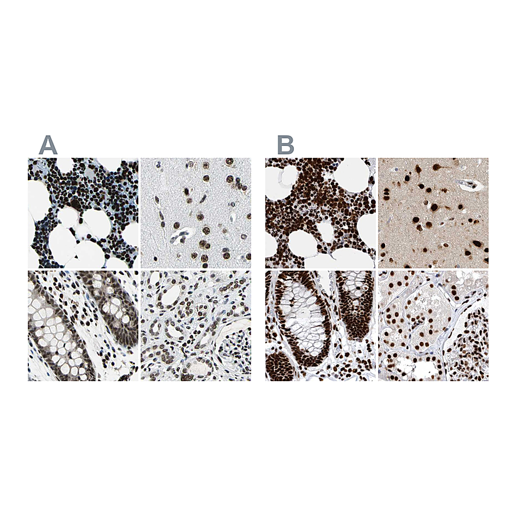 Atlas Antibodies Anti-BCLAF1 Antibody