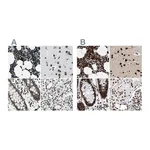 Atlas Antibodies Anti-BCLAF1 Antibody